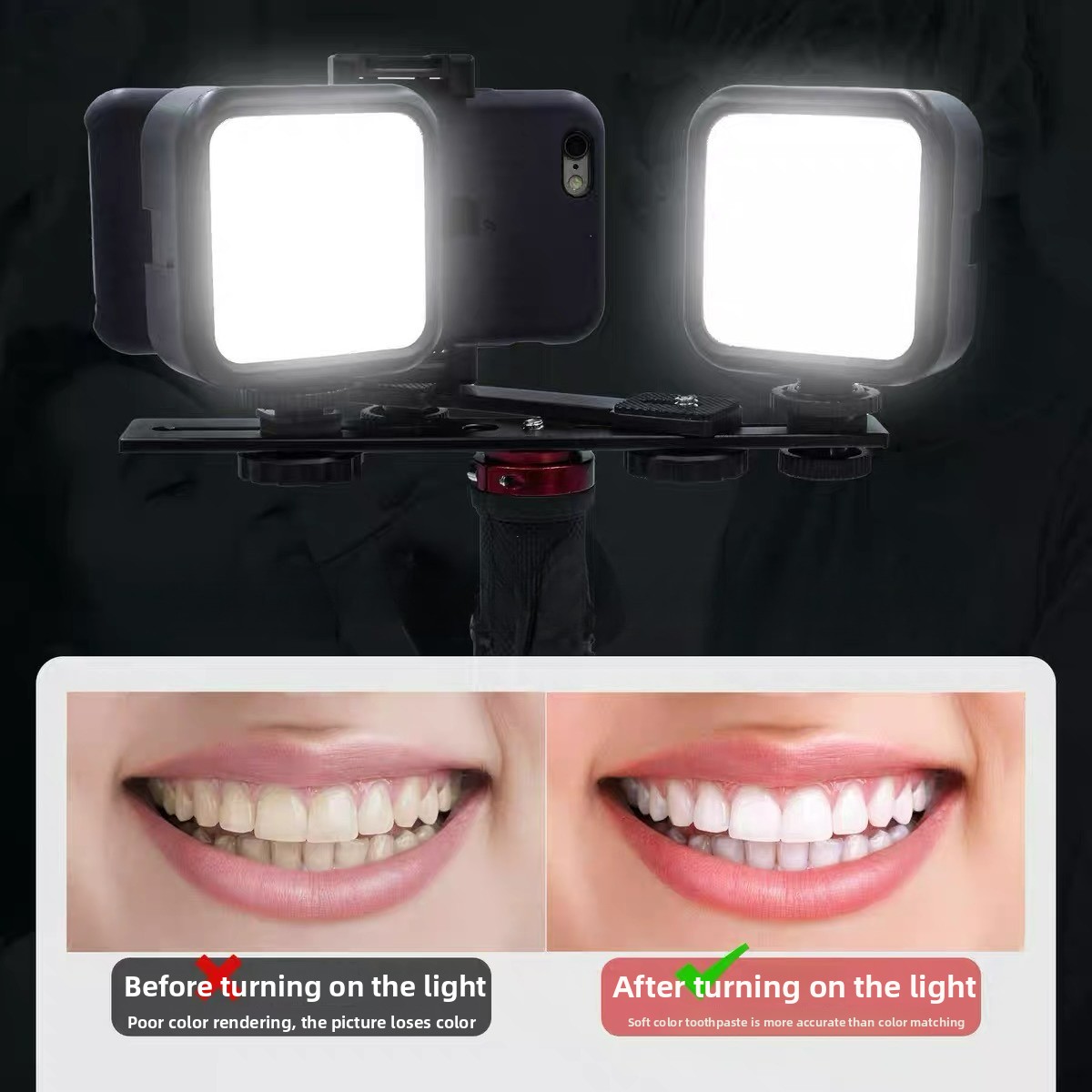 Dental Photography Light with  - đánh giá và giá Photography Lighting Basics